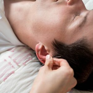 5 Wellness Acupuncture Sessions