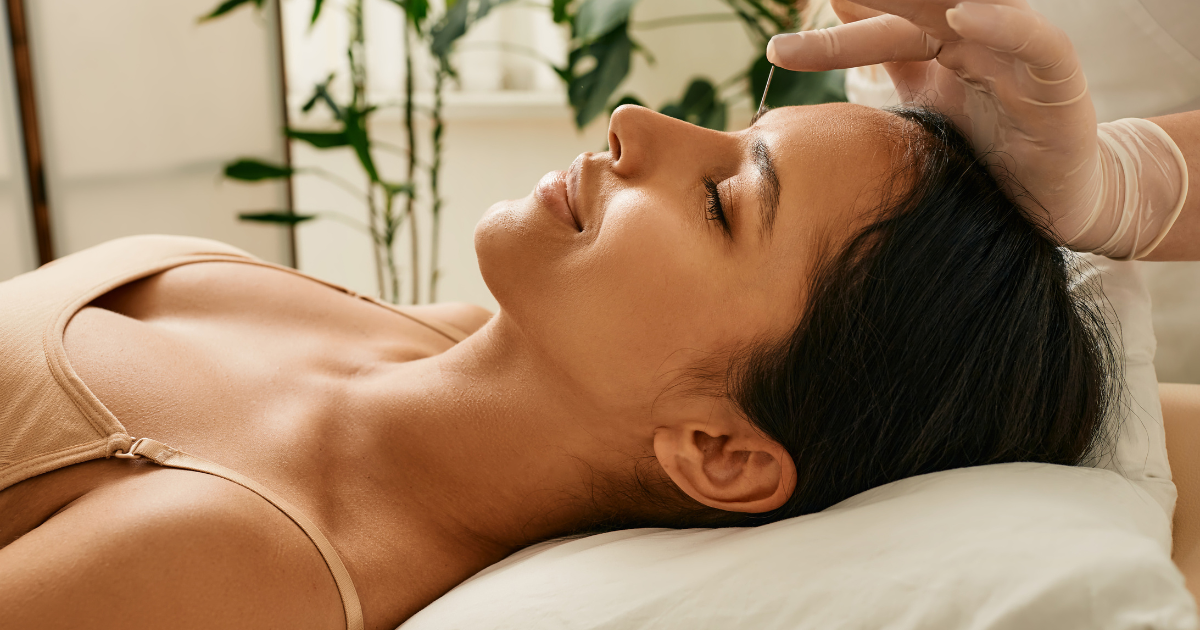 The Magic Of Aesthetic Acupuncture: A Natural Approach To Aging