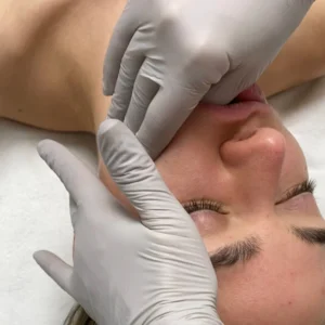 Unlock the Secret to a Sculpted, Stress-Free Face: The Magic of Buccal Massage and Its Power Duo with Facial Acupuncture!